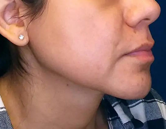 After